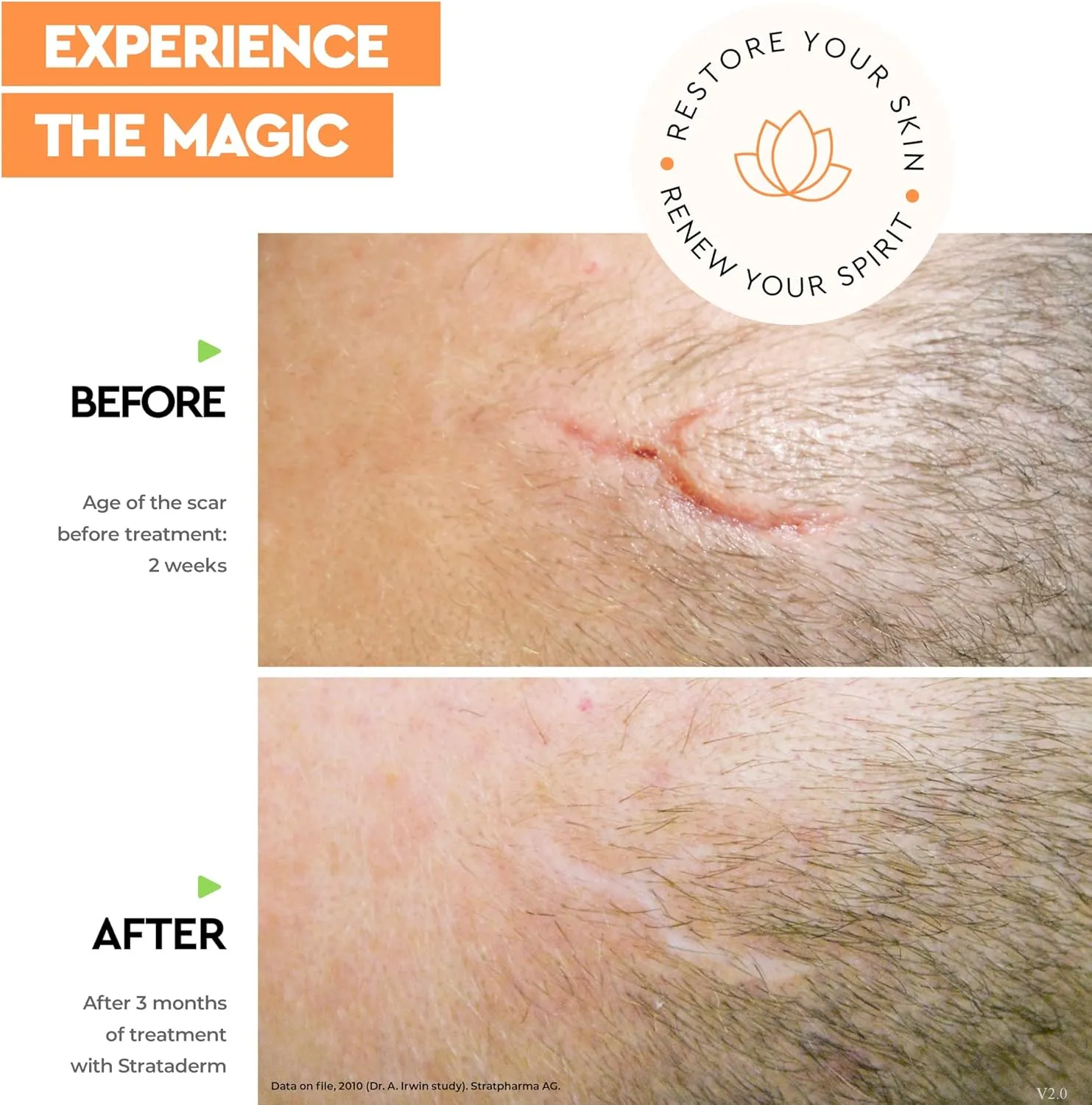 Strataderm Professional Scar Therapy Gel | Old and New Scars from General Surgery, Trauma, Wounds, Burns, Bites, Acne & Skin Disease | Reduces Redness, Discoloration, Discomfort & Itch | 10g (0.35oz)